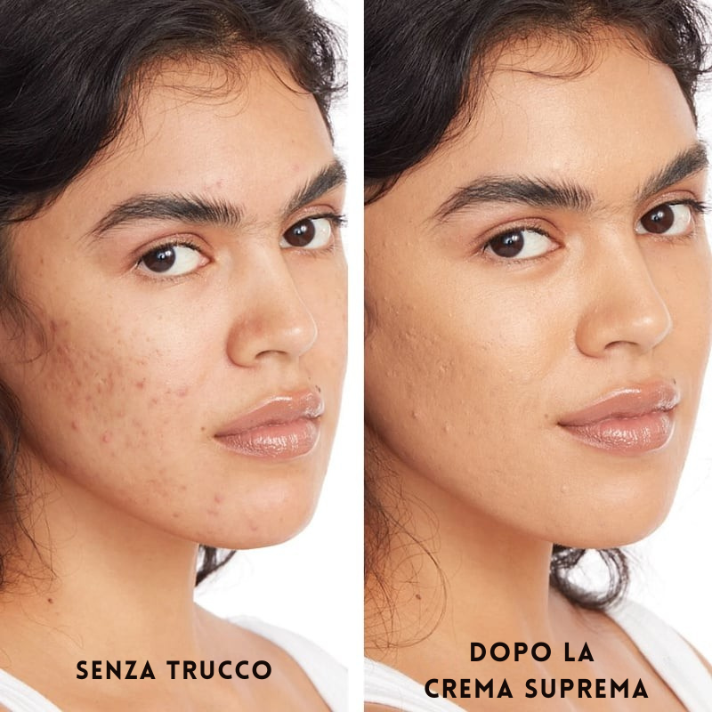 Crema Suprema Tutto-in-Uno
